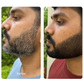 No More Grey Serum